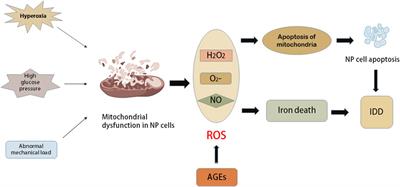 The role of ageing and oxidative stress in intervertebral disc degeneration